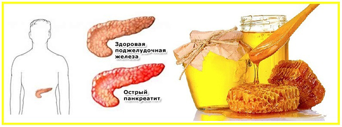 Мед при панкреатите